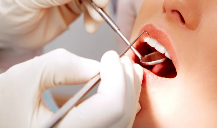 Dental Check-Ups